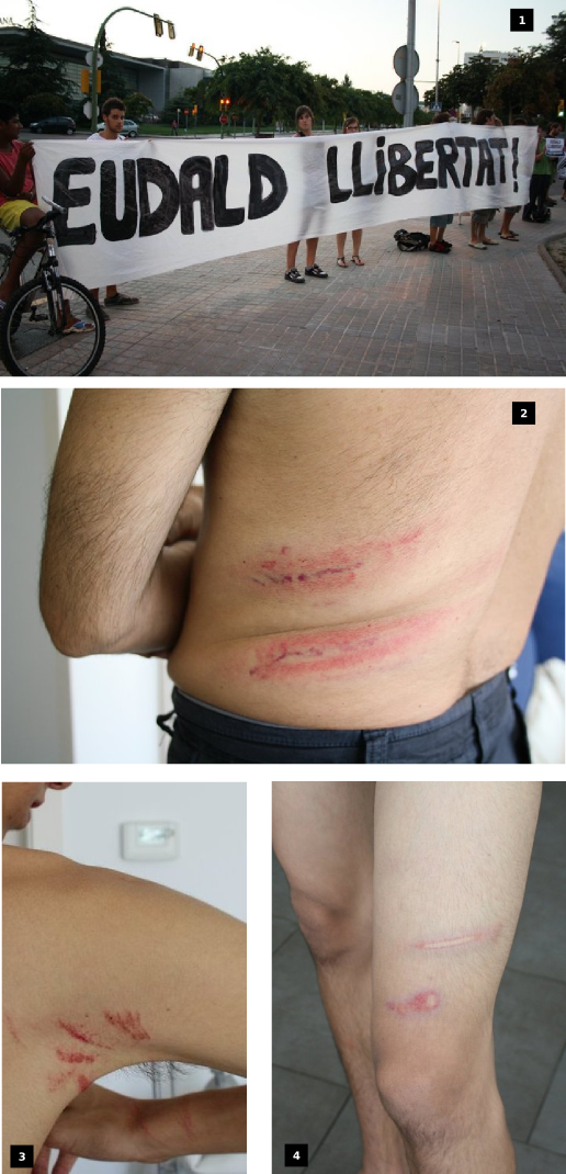 detencio_eudald_calvo_agressions_policials