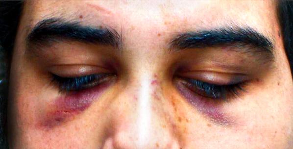 Tres joves graciencs demanen la reobertura d'un cas de tortures de la Guàrdia Urbana de Barcelona 10 anys després [VÍDEO]