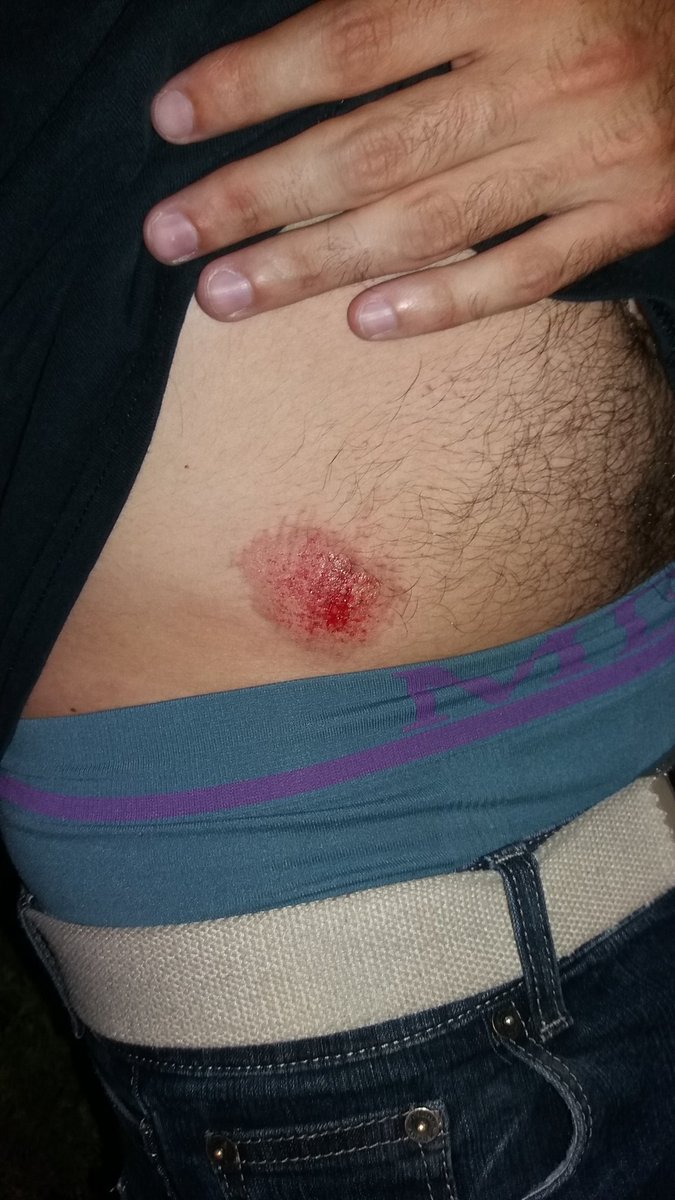 agressiovalencia